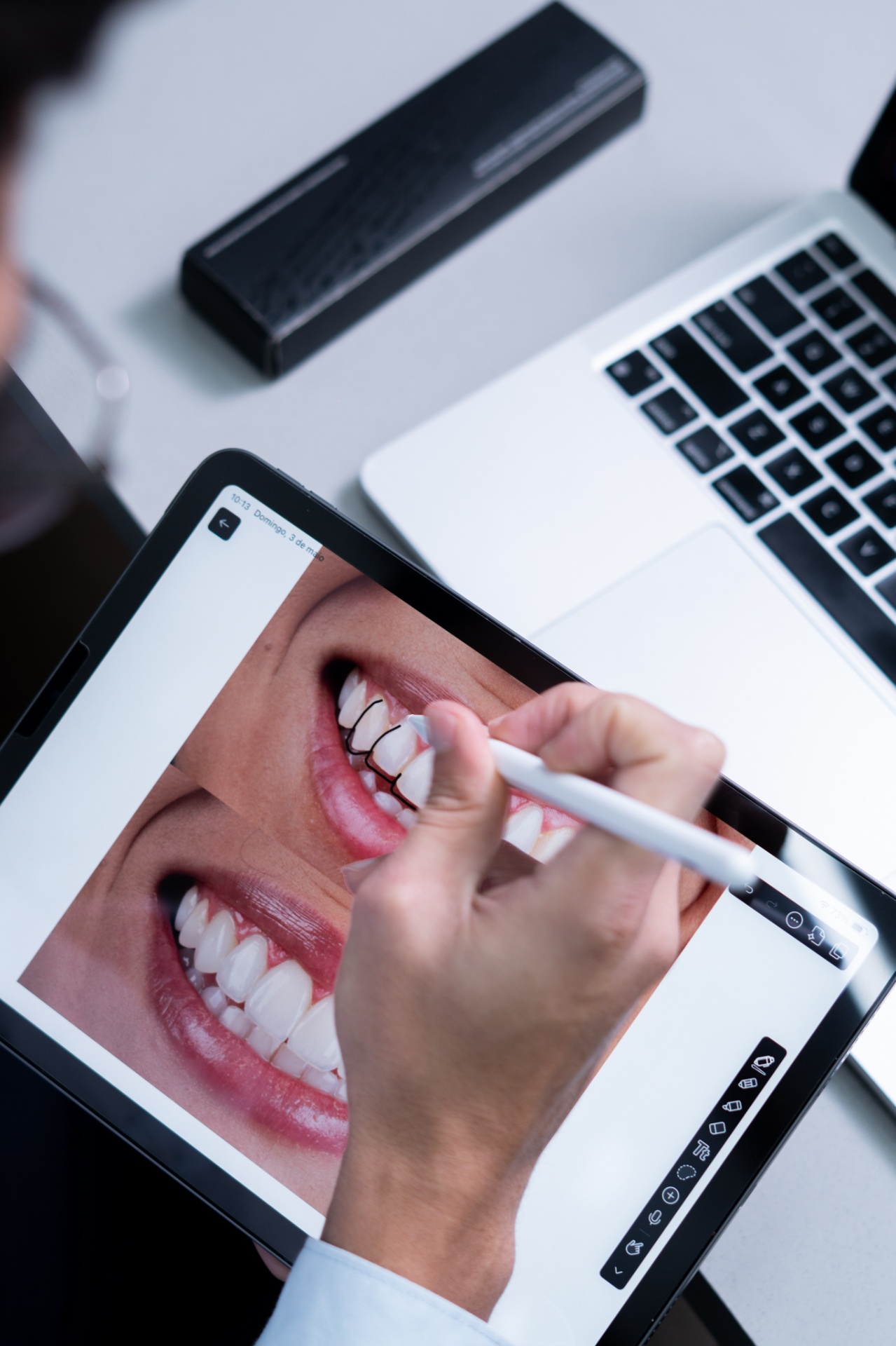 Dentista analisando planejamento digital de lentes de resina em tablet